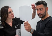 FUE hair transplant near me