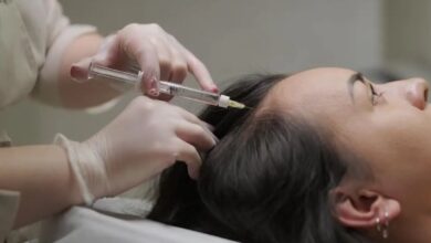 PRP Treatment for Hair Loss