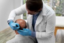 Chicago hair transplant expert