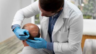 Chicago hair transplant expert