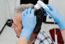 Exosomes Treatment​