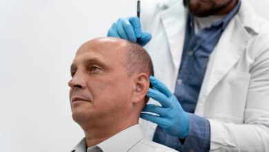 Hair loss solutions Chicago